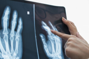 医療画像の診断支援