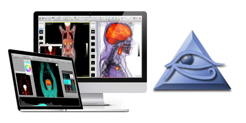 OsiriX | MacOS X対応 医用画像 解析 ソフトウェア