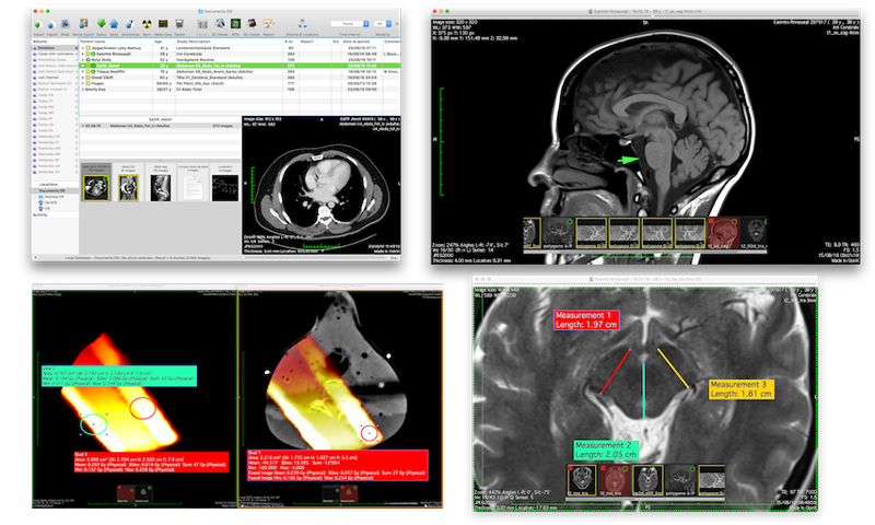 OsiriX | MacOS X対応 医用画像 解析 ソフトウェア