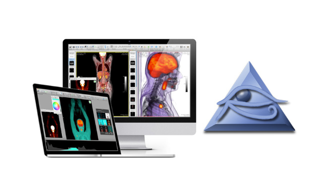 OsiriX